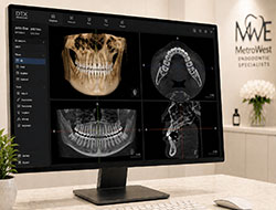 CBCT results